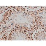 Phospho-IGF1R (Tyr1346) Antibody in Immunohistochemistry (Paraffin) (IHC (P))