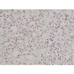 Phospho-IGF1R (Tyr1346) Antibody in Immunohistochemistry (Paraffin) (IHC (P))