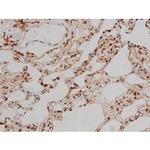 Phospho-IGF1R (Tyr1346) Antibody in Immunohistochemistry (Paraffin) (IHC (P))