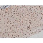 Phospho-IGF1R (Tyr1346) Antibody in Immunohistochemistry (Paraffin) (IHC (P))