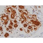 Phospho-IGF1R (Tyr1346) Antibody in Immunohistochemistry (Paraffin) (IHC (P))