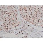 Phospho-IGF1R (Tyr1346) Antibody in Immunohistochemistry (Paraffin) (IHC (P))