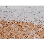 Phospho-IGF1R (Tyr1346) Antibody in Immunohistochemistry (Paraffin) (IHC (P))