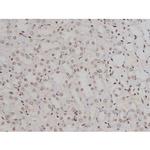 Phospho-IGF1R (Tyr1346) Antibody in Immunohistochemistry (Paraffin) (IHC (P))