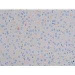 Phospho-IGF1R (Tyr1161) Antibody in Immunohistochemistry (Paraffin) (IHC (P))