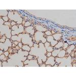 Phospho-IGF1R (Tyr1161) Antibody in Immunohistochemistry (Paraffin) (IHC (P))