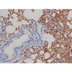 Phospho-IGF1R (Tyr1161) Antibody in Immunohistochemistry (Paraffin) (IHC (P))