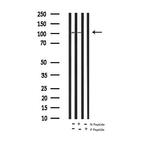 Phospho-Androgen Receptor (Ser651) Antibody in Western Blot (WB)