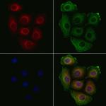 Phospho-Bcr (Tyr360) Antibody in Immunocytochemistry (ICC/IF)