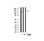 Phospho-FGFR1 (Tyr766) Antibody in Western Blot (WB)