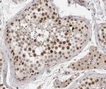 Phospho-SRF (Ser103) Antibody in Immunohistochemistry (Paraffin) (IHC (P))