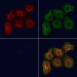 Phospho-SRC (Tyr530) Antibody in Immunocytochemistry (ICC/IF)