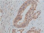 Phospho-SRC (Tyr530) Antibody in Immunohistochemistry (Paraffin) (IHC (P))