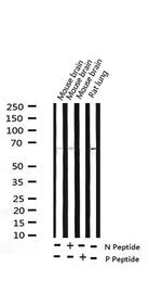 Phospho-SRC (Ser75) Antibody in Western Blot (WB)