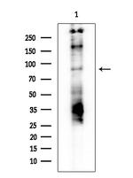 Phospho-GYS1 (Ser645) Antibody in Western Blot (WB)