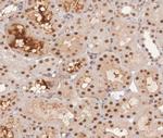 Phospho-GYS1 (Ser645) Antibody in Immunohistochemistry (Paraffin) (IHC (P))