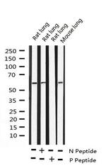 Phospho-Cyclin B1 (Ser126) Antibody in Western Blot (WB)