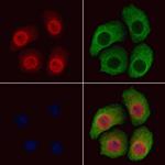 Phospho-B-RAF (Ser446) Antibody in Immunocytochemistry (ICC/IF)