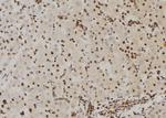 Phospho-B-RAF (Ser446) Antibody in Immunohistochemistry (Paraffin) (IHC (P))