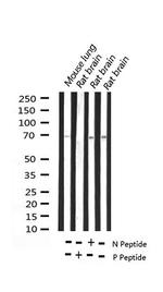 Phospho-Ezrin (Thr567) Antibody in Western Blot (WB)