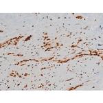 Phospho-Ezrin (Tyr354) Antibody in Immunohistochemistry (Paraffin) (IHC (P))