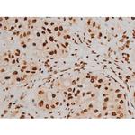 Phospho-Ezrin (Tyr354) Antibody in Immunohistochemistry (Paraffin) (IHC (P))