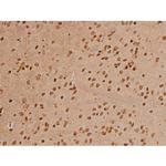 Phospho-Ezrin (Tyr354) Antibody in Immunohistochemistry (Paraffin) (IHC (P))