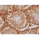 Phospho-Ezrin (Tyr354) Antibody in Immunohistochemistry (Paraffin) (IHC (P))