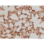 Phospho-Ezrin (Tyr354) Antibody in Immunohistochemistry (Paraffin) (IHC (P))