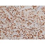 Phospho-Ezrin (Tyr354) Antibody in Immunohistochemistry (Paraffin) (IHC (P))