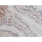 Phospho-Ezrin (Tyr478) Antibody in Immunohistochemistry (Paraffin) (IHC (P))