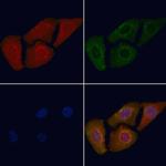 Phospho-Ezrin (Tyr146) Antibody in Immunocytochemistry (ICC/IF)