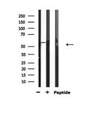 Phospho-ATF2 (Ser62, Ser44) Antibody in Western Blot (WB)