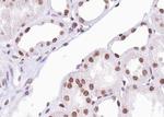 Phospho-ATF2 (Ser112, Ser94) Antibody in Immunohistochemistry (Paraffin) (IHC (P))