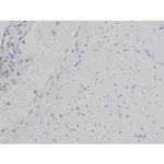 Phospho-ATF2 (Thr71, Thr53) Antibody in Immunohistochemistry (Paraffin) (IHC (P))