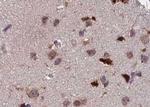 Phospho-ATF2 (Thr73, Thr55) Antibody in Immunohistochemistry (Paraffin) (IHC (P))