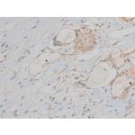 Phospho-CREB (Ser142) Antibody in Immunohistochemistry (Paraffin) (IHC (P))