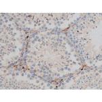 Phospho-CREB (Ser142) Antibody in Immunohistochemistry (Paraffin) (IHC (P))