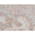 Phospho-CREB (Ser142) Antibody in Immunohistochemistry (Paraffin) (IHC (P))