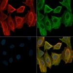 Phospho-PDGFRa (Tyr849) Antibody in Immunocytochemistry (ICC/IF)