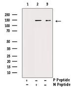 Phospho-PDGFRa (Tyr849) Antibody in Western Blot (WB)