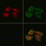 Phospho-Stathmin 1 (Ser16) Antibody in Immunocytochemistry (ICC/IF)