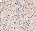 Phospho-Stathmin 1 (Ser16) Antibody in Immunohistochemistry (Paraffin) (IHC (P))