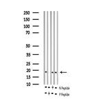 Phospho-Stathmin 1 (Ser16) Antibody in Western Blot (WB)