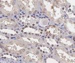 Phospho-Stathmin 1 (Ser25) Antibody in Immunohistochemistry (Paraffin) (IHC (P))