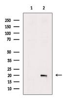 Phospho-Stathmin 1 (Ser25) Antibody in Western Blot (WB)