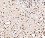 Phospho-Stathmin 1 (Ser38) Antibody in Immunohistochemistry (Paraffin) (IHC (P))