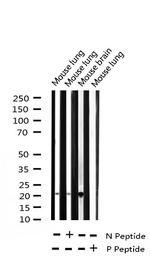 Phospho-Stathmin 1 (Ser38) Antibody in Western Blot (WB)