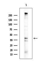 Phospho-Connexin 43 (Ser368) Antibody in Western Blot (WB)