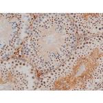 Phospho-JunD (Ser255) Antibody in Immunohistochemistry (Paraffin) (IHC (P))